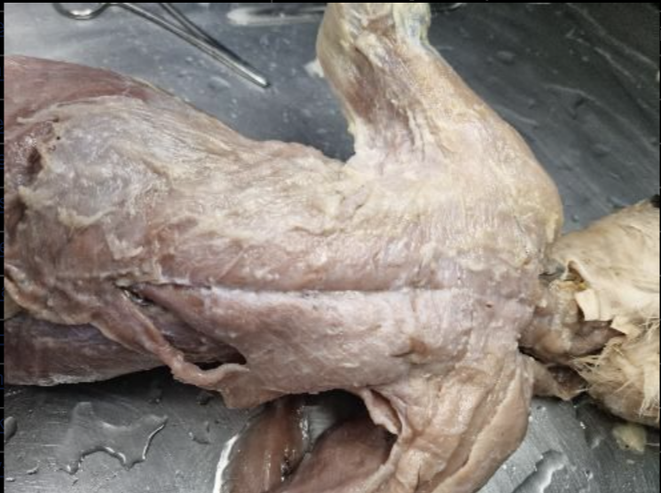 肌肉纤维识别数据集-海院数据集